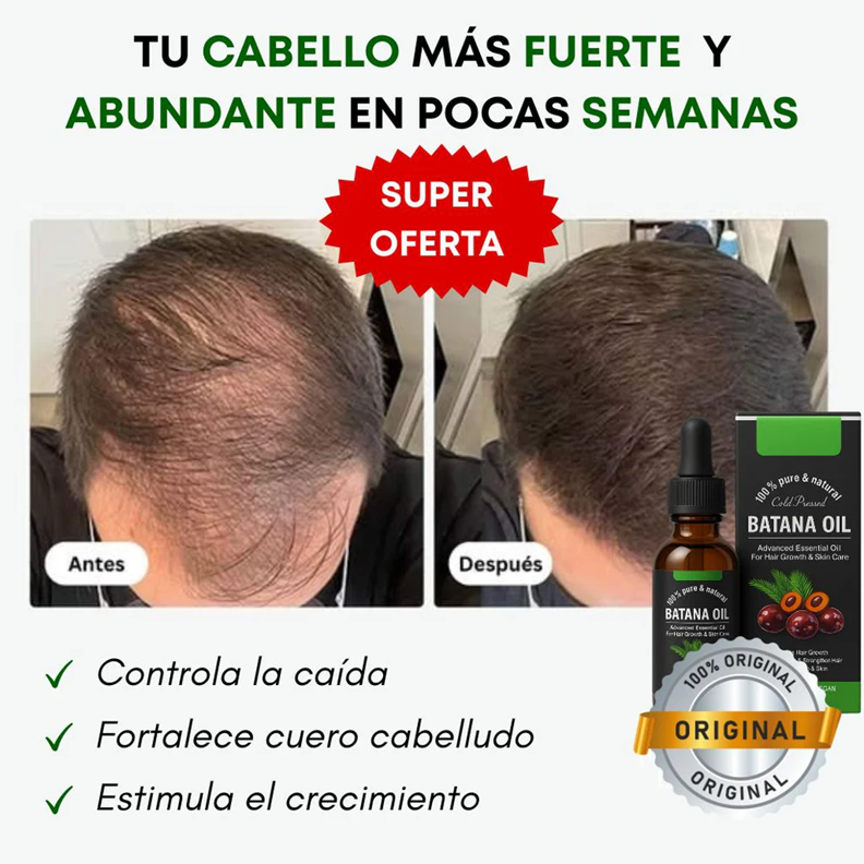 Aceite Batana ORIGINAL: El Secreto Ancestral para Prevenir la Caída del Cabello y Estimular el Crecimiento 🍀