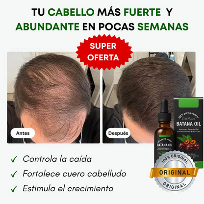 Aceite Batana ORIGINAL: El Secreto Ancestral para Prevenir la Caída del Cabello y Estimular el Crecimiento 🍀